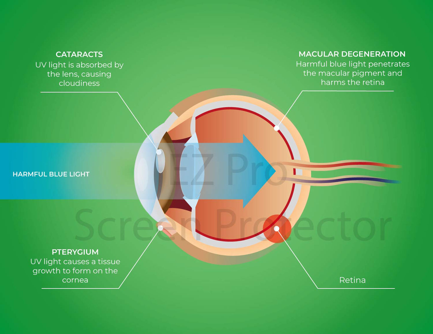 Anti Blue Light Screen filter for 21 and 22 Inches Widescreen Desktop Monitor, Blocks Excessive Harmful Blue Light, Reduce Eye Fatigue and Eye Strain
