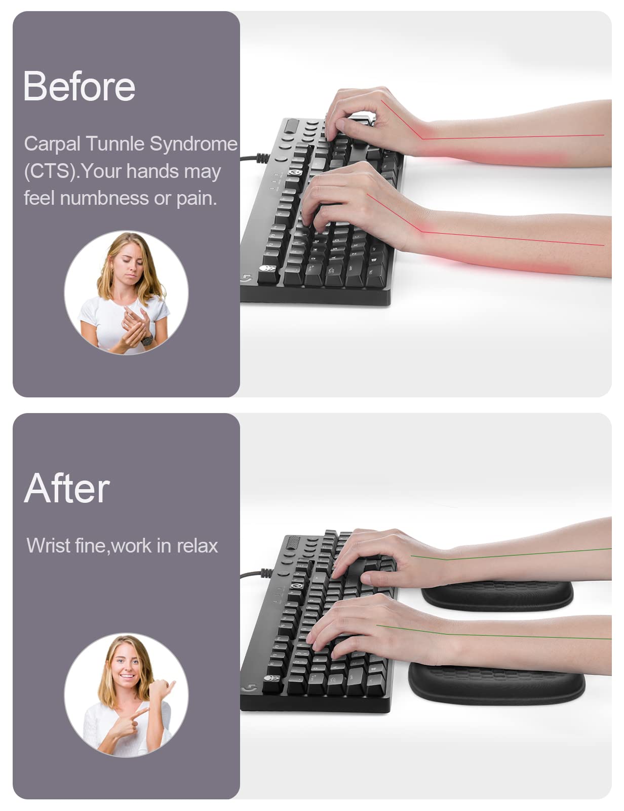 Vaydeer 2Pcs Cloud Elbow Pads, Desk Arm Rest Support, Soft Memory Foam Wrist Rest, Ergonomic Cushion Carpal Tunnel Pain Relief Gel Mouse Pillow for Computer Laptop Office Gaming Car Chair Accessory