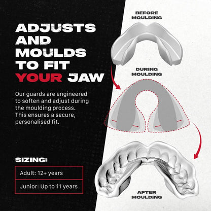 SAFEJAWZ Mouth Guard, Slim Fit Mouthguard for Youth with Case, Easy Fit Remoldable Mouthpiece for Football, Boxing, Lacrosse, MMA, Basketball & All Contact Sports (Kids <11 Years, Clear)