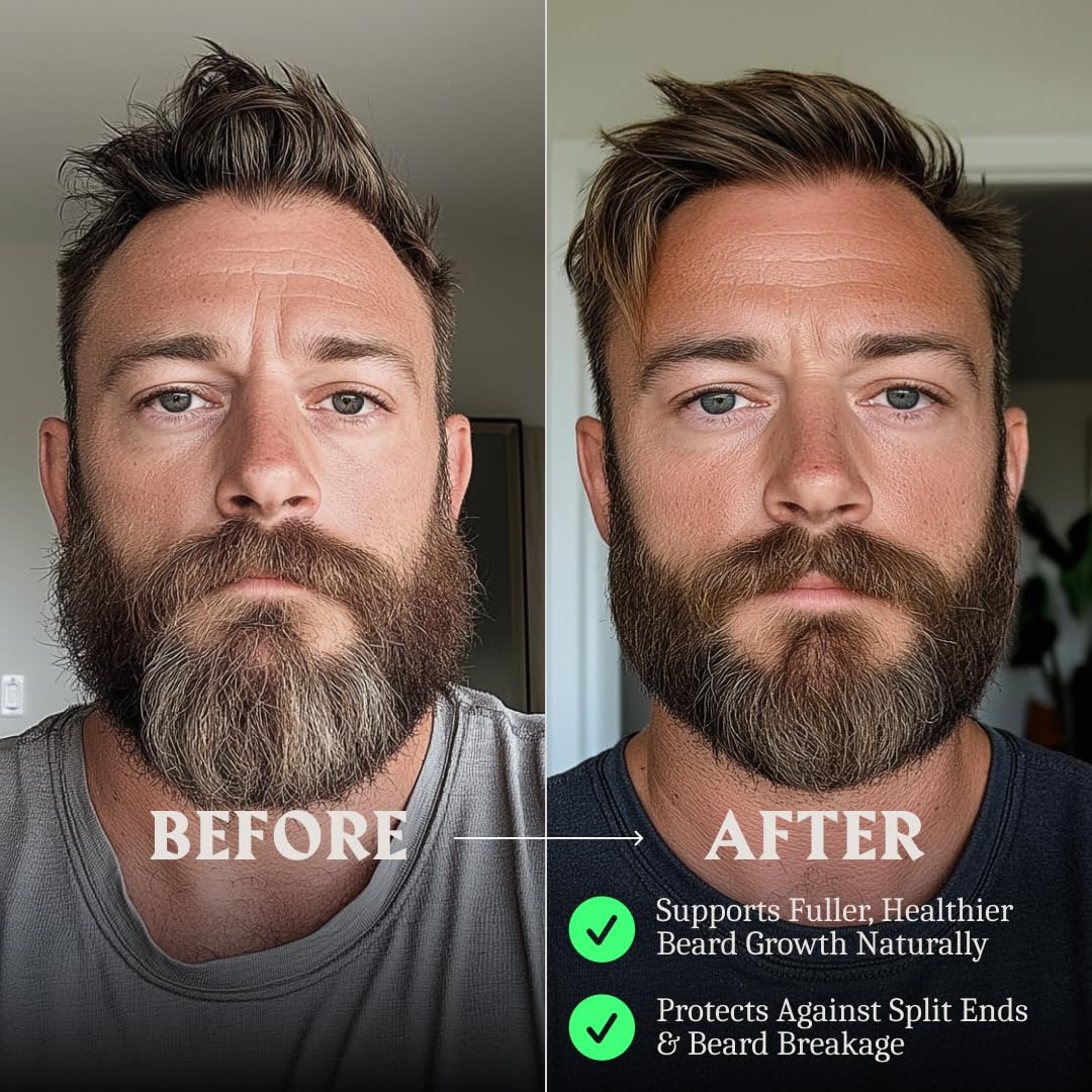 Striking Viking Beard Oil with Biotin for Men - 2 Fl Oz, 1 Pack, Sandalwood - Thickening & Conditioning Beard Growth Oil & Serum with Argan & Jojoba for Hydrated Facial Hair