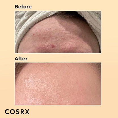 COSRX Snail Mucin 96% Power Repairing Essence 100ml, Hydrating Serum for Face with Snail Secretion Filtrate for Dull Skin & Fine Lines, Korean Skincare