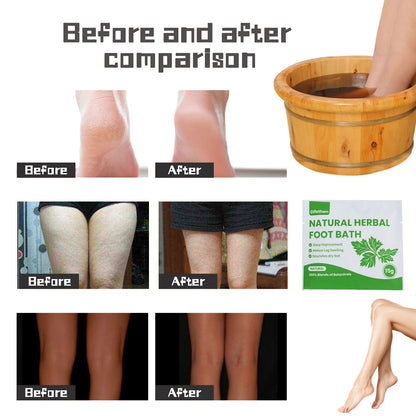 Natural Mugwort/Wormwood Herbal Foot Soak,Lymphatic Ginger Foot Bath Bag, Anti-Swelling Foot SPA Promote Metabolism, Foot Care 15g/PCS (10PCS)