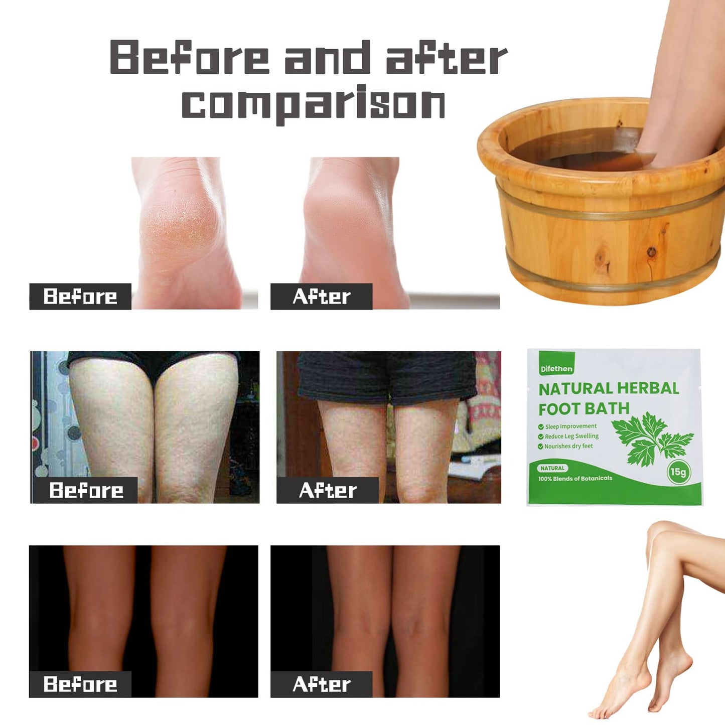 Natural Mugwort/Wormwood Herbal Foot Soak,Lymphatic Ginger Foot Bath Bag, Anti-Swelling Foot SPA Promote Metabolism, Foot Care 15g/PCS (10PCS)