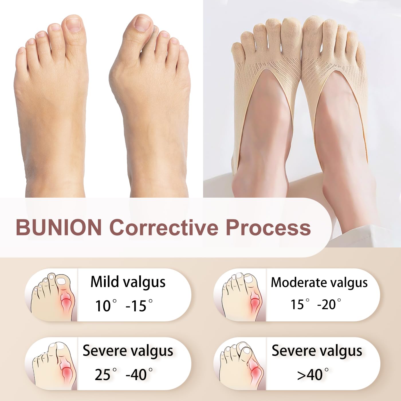 MoHern 6 Pairs Toe Socks for Bunions, Low Cut Sockalign USA Toe Socks for Women, Five Finger Bunion Socks for Women