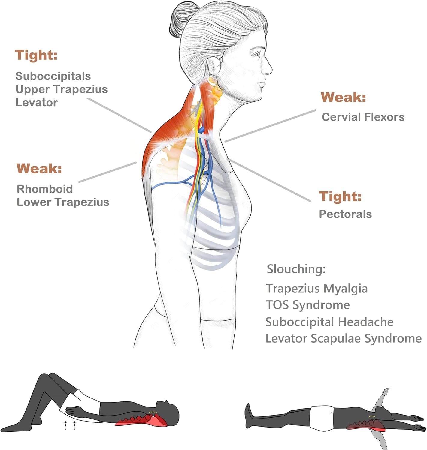 Trapezius Trigger Point Massager, Myofasical Release Neck and Shoulder Pain, Suboccipital Release Tool, Posture Corrector, Relieve Upper Back Pain &Tension Headache