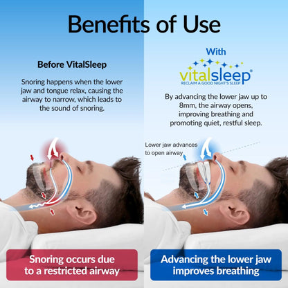 VitalSleep Anti-Snoring Mouthpiece, Comfortable & Adjustable Snore Guard, Quiets Snoring, USA Made, BPA Free & FDA Cleared Anti-Snore Device – Men’s Size