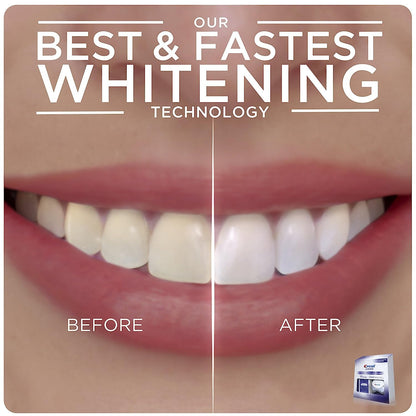 Crest 3D Whitestrips with Light, Teeth Whitening Strip Kit, 20 Strips (10 Count Pack)