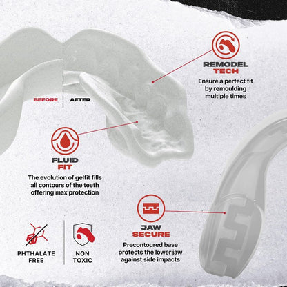 SAFEJAWZ Mouth Guard, Slim Fit Mouthguard for Youth with Case, Easy Fit Remoldable Mouthpiece for Football, Boxing, Lacrosse, MMA, Basketball & All Contact Sports (Kids <11 Years, Clear)